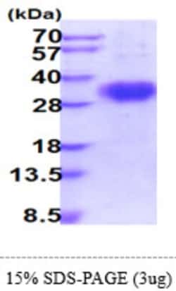 Novus Biologicals&trade;&nbsp;Recombinant Human Fc gamma RIII (CD16) Protein